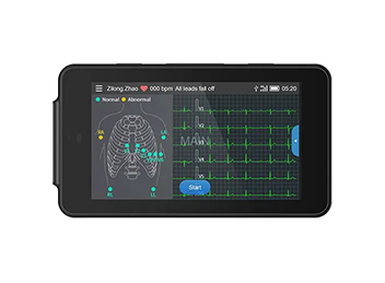 Confronto di macchine Ecg portatili e sistemi di monitoraggio Holter