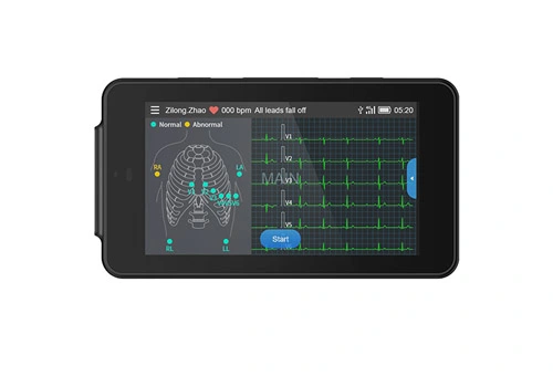 Lepu Medical Handheld PCECG-500 Pocket ECG Machine Monitor ECG portatile a 12 derivazioni per la clinica domestica e l'assistenza sanitaria primaria